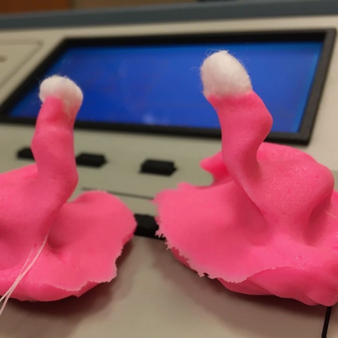 picture of perfect audiologist ear impressions for IEM custom in ear monitors vancouver